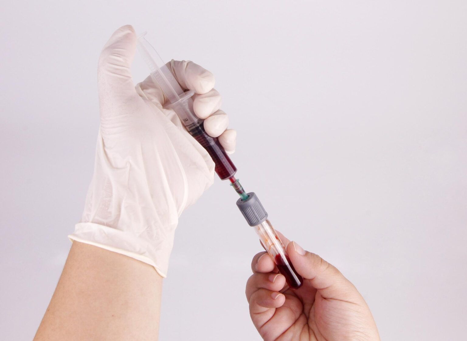 How the P-Shot Can Improve Your Relationship